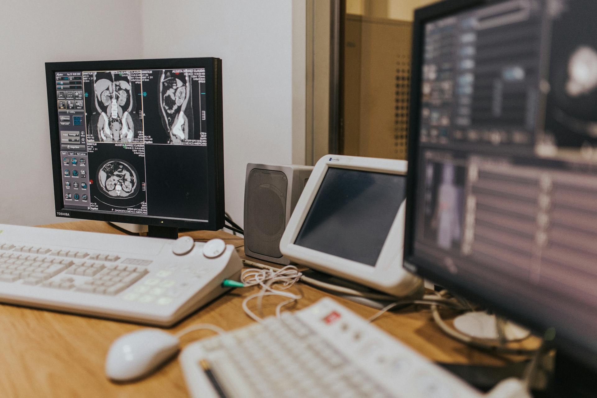 Radiology workstation with multiple monitors displaying CT scan images, along with keyboards and a mouse on a desk.